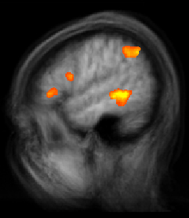 results of fmri scan done on study participants